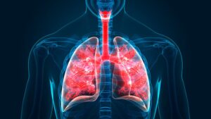 Read more about the article Medicamente utilizate în tratamentul afecțiunilor respiratorii